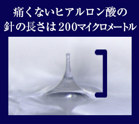 ヒアルロン酸針