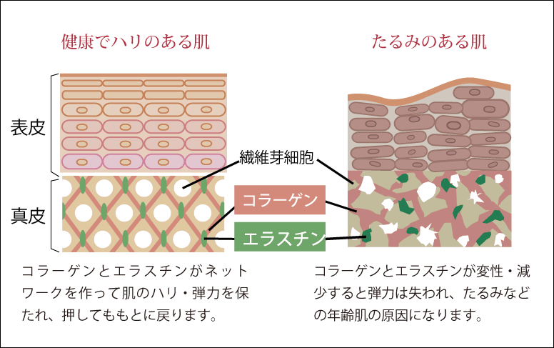 左：若い肌　右：老化した肌