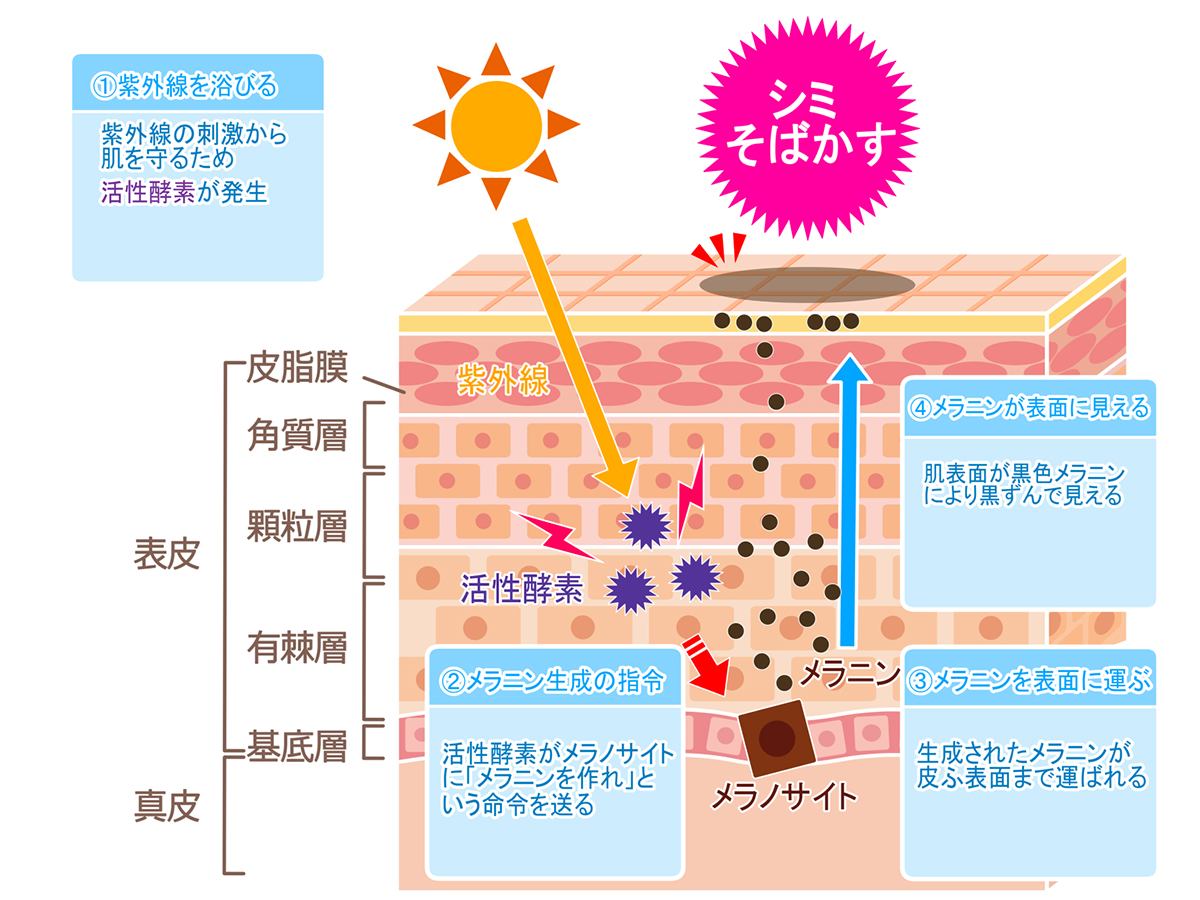 シミ・ソバカスができるメカニズム