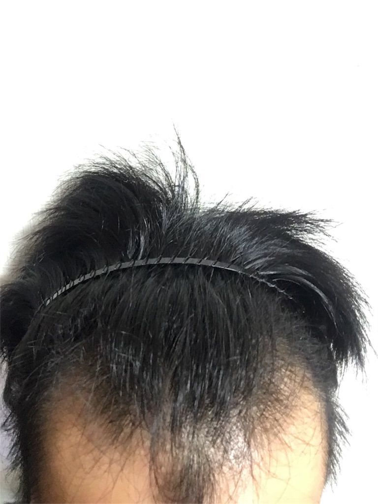 f:id:ouda12-12:20180909213611j:plain f:id:ouda12-12:20180909213611j:plain