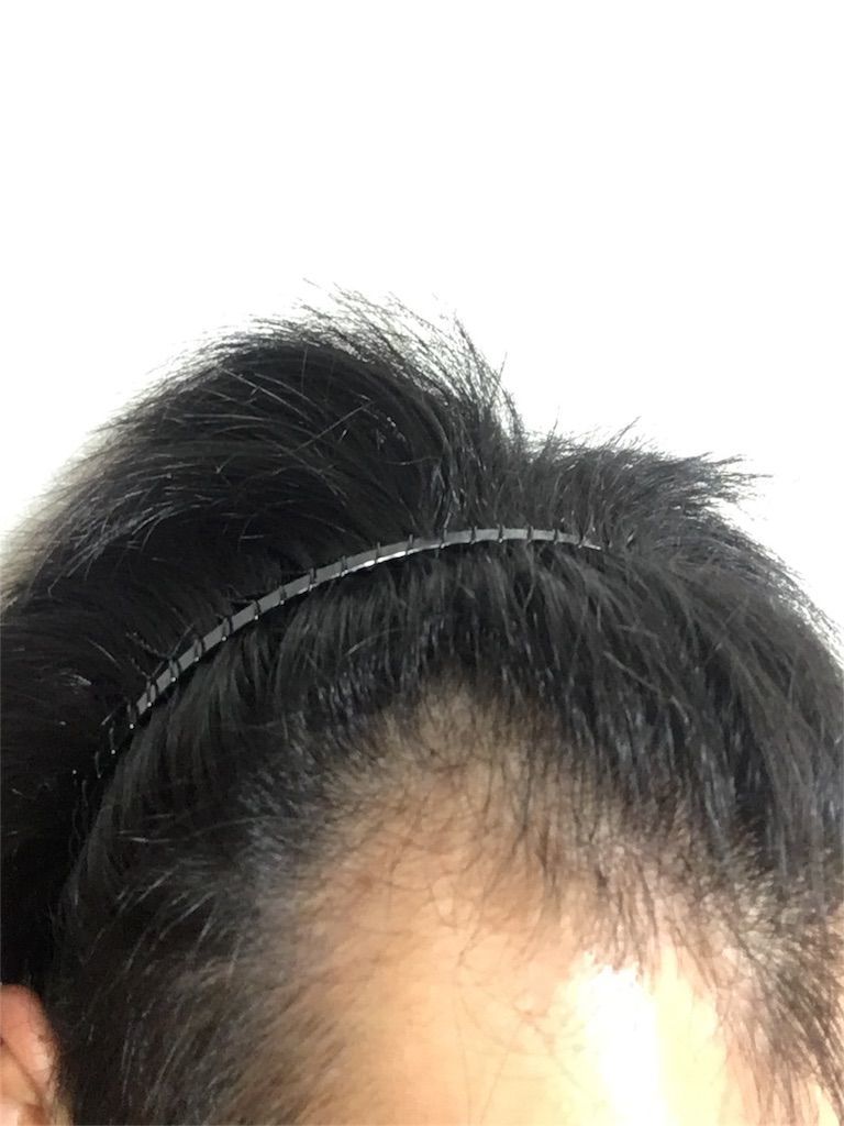 f:id:ouda12-12:20180909213614j:plain f:id:ouda12-12:20180909213614j:plain