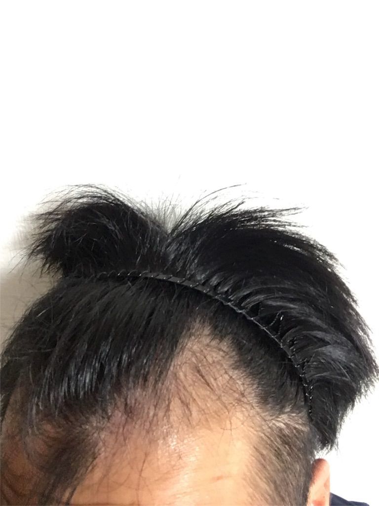 f:id:ouda12-12:20180909213730j:plain f:id:ouda12-12:20180909213730j:plain