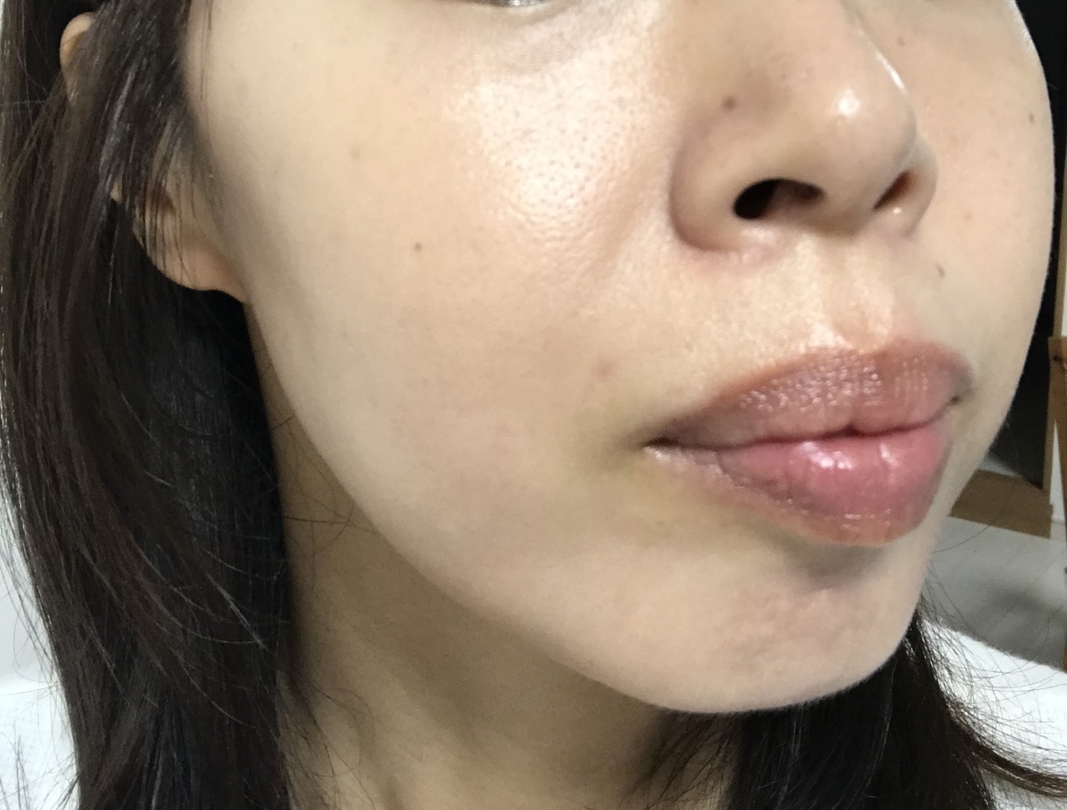 f:id:over30_biyou:20191023214615j:plain f:id:over30_biyou:20191023214615j:plain