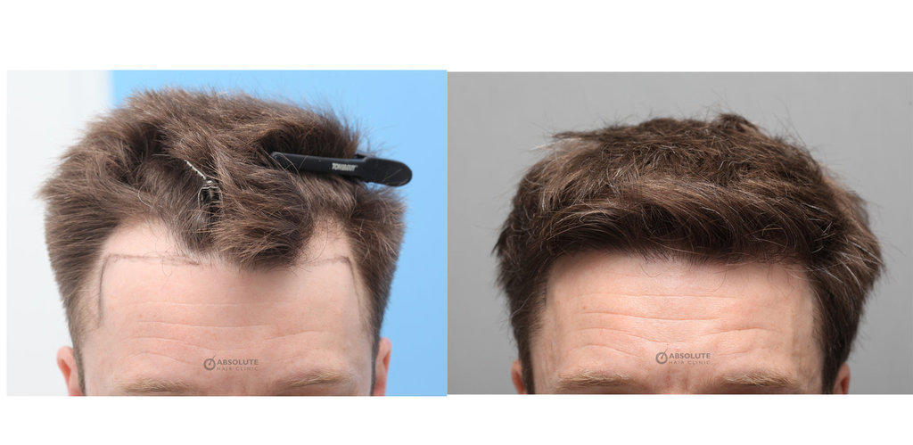 f:id:pagetan:20191226232548j:plain f:id:pagetan:20191226232548j:plain