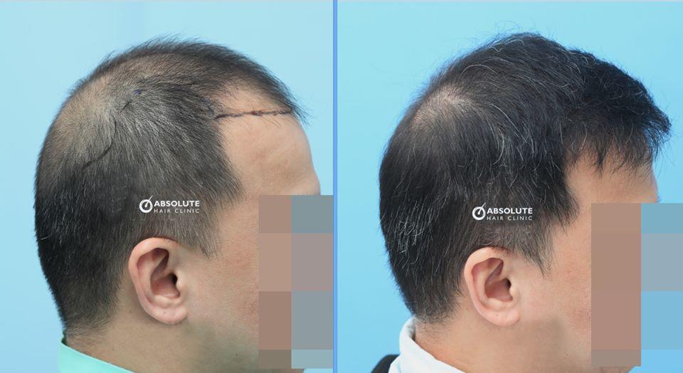 f:id:pagetan:20200418234108j:plain f:id:pagetan:20200418234108j:plain