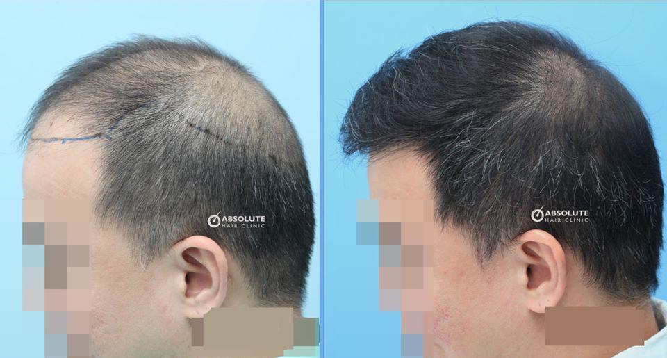 f:id:pagetan:20200418234118j:plain f:id:pagetan:20200418234118j:plain