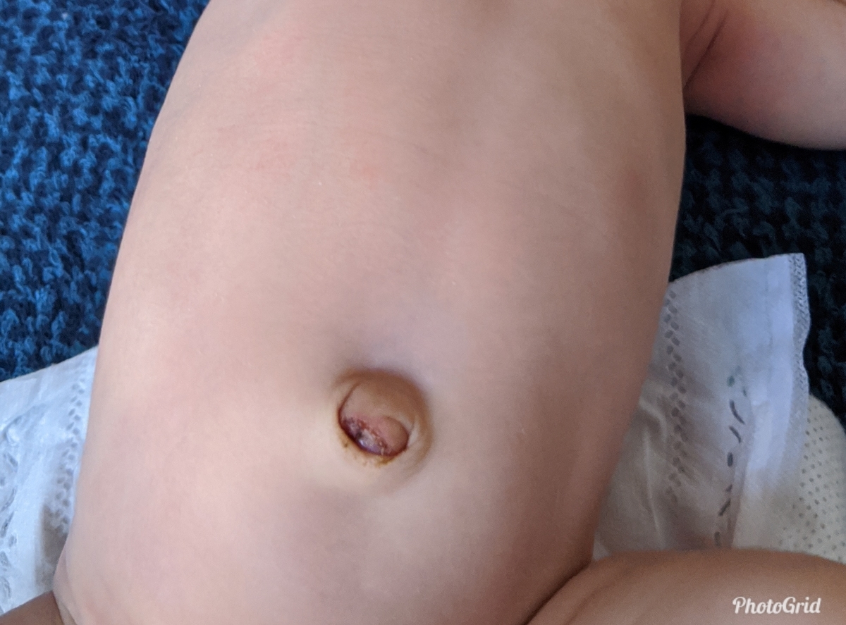 f:id:pakochan:20200719115457j:plain