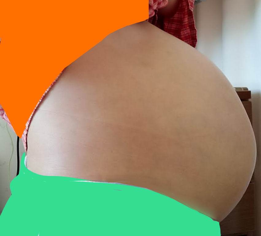 お腹が張り裂けそうで怖いです パントメはキャタピラー お腹が張り裂けそうで怖いです パントメはキャタピラー
