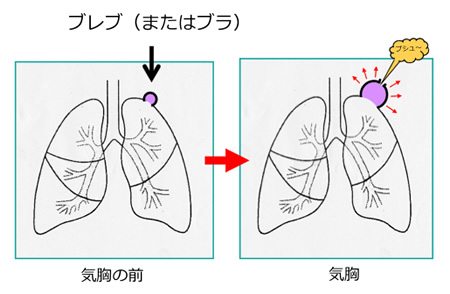 f:id:papachannel:20200109153107j:plain f:id:papachannel:20200109153107j:plain