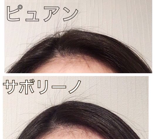 f:id:para0909worker:20181010220141j:plain f:id:para0909worker:20181010220141j:plain
