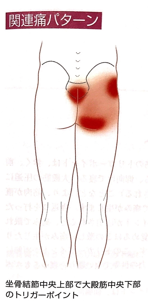 1月26日 日 関東 腰痛 坐骨神経痛に対するトリガーポイント療法 Oriental Physio Academy