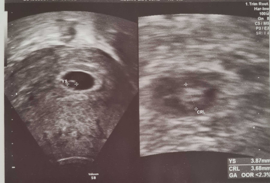 f:id:pawpawsock:20210402192141p:plain