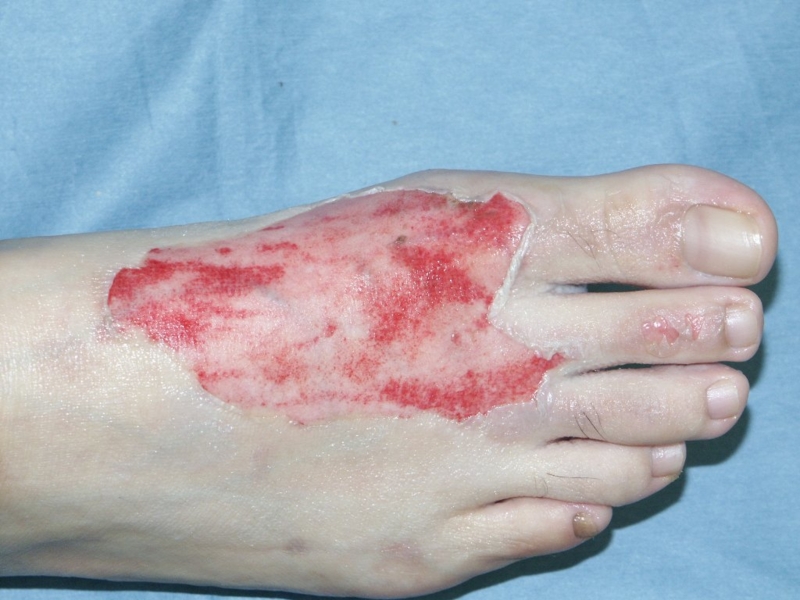 f:id:pediatrician:20120730183920j:image:w360