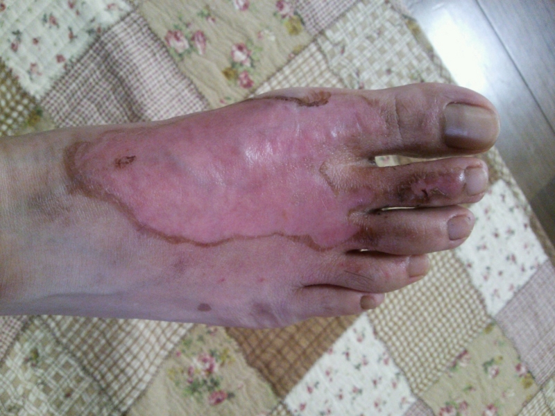 f:id:pediatrician:20120820103333j:image:w360