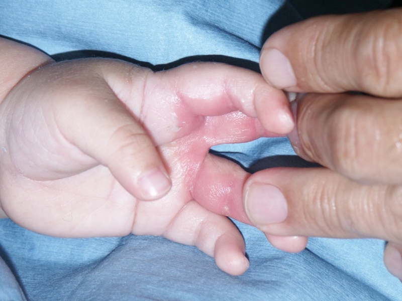 f:id:pediatrician:20120820170449j:image f:id:pediatrician:20120820170449j:image