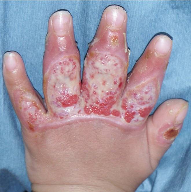 f:id:pediatrician:20120821092710j:image