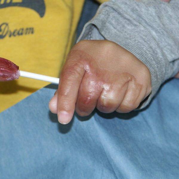 f:id:pediatrician:20120821092743j:image