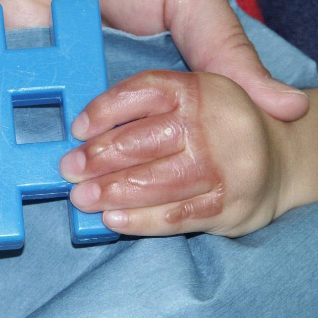 f:id:pediatrician:20120821092745j:image