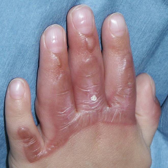 f:id:pediatrician:20120821092746j:image