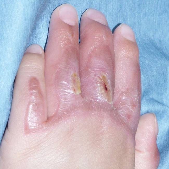 f:id:pediatrician:20120821092750j:image