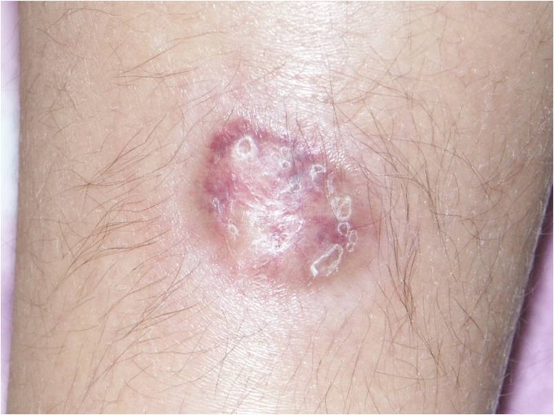 f:id:pediatrician:20120822084428j:image