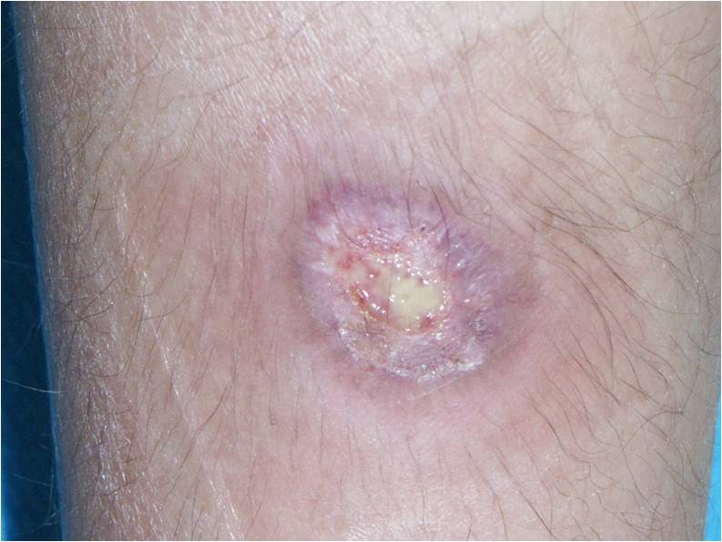 f:id:pediatrician:20120822084429j:image