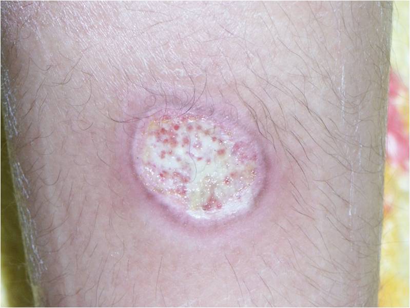 f:id:pediatrician:20120822084430j:image