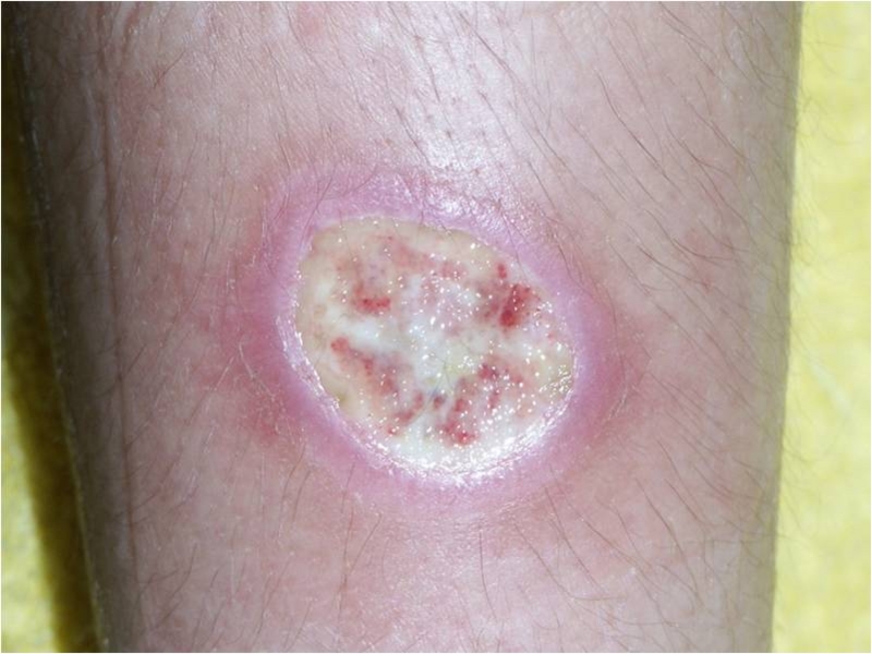 f:id:pediatrician:20120822084432j:image