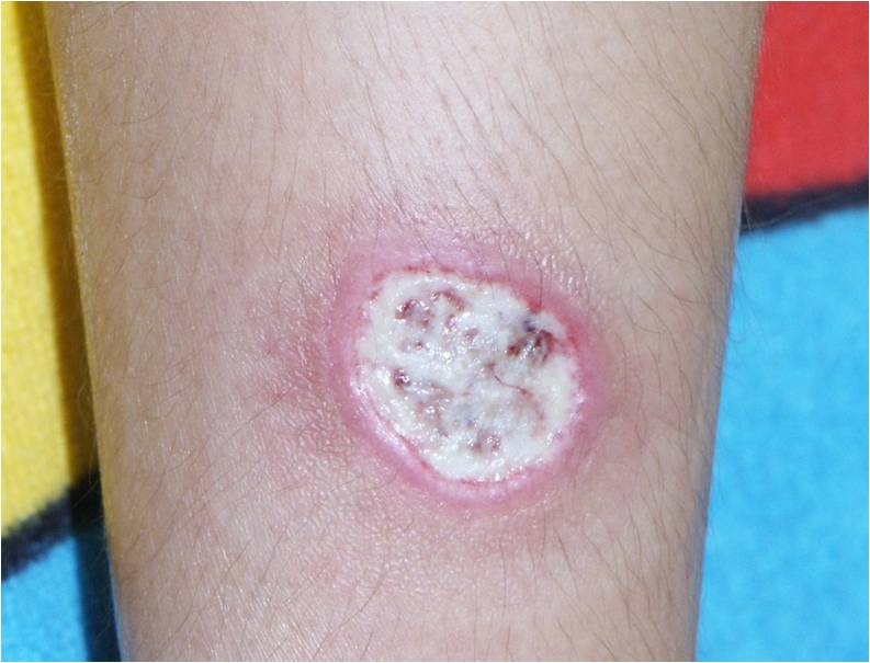 f:id:pediatrician:20120822084433j:image