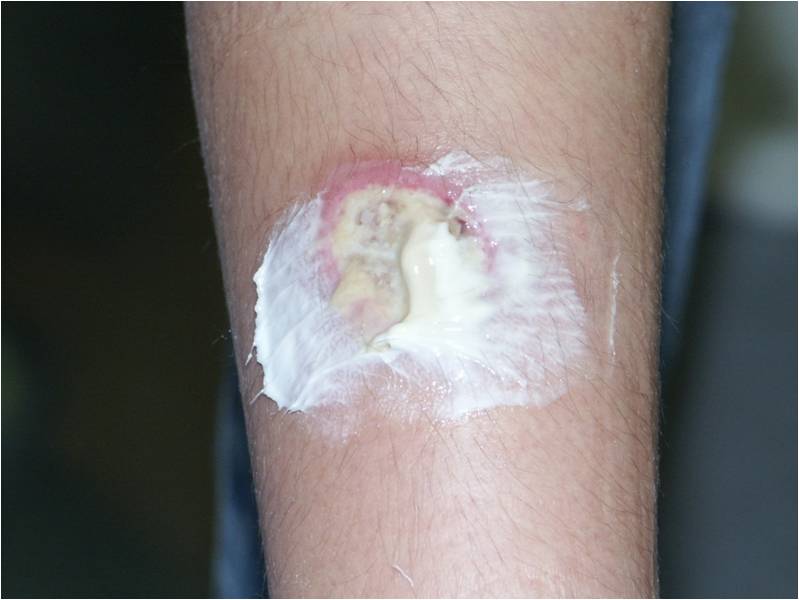 f:id:pediatrician:20120822084434j:image