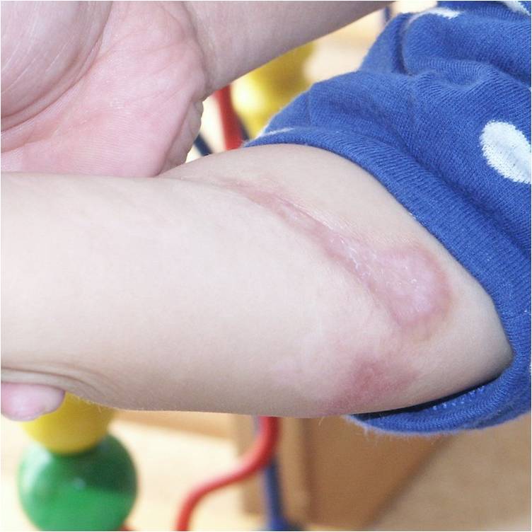 f:id:pediatrician:20120822110944j:image