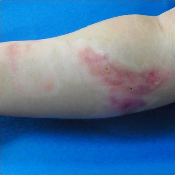 f:id:pediatrician:20120822110945j:image