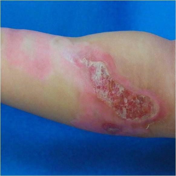 f:id:pediatrician:20120822110947j:image