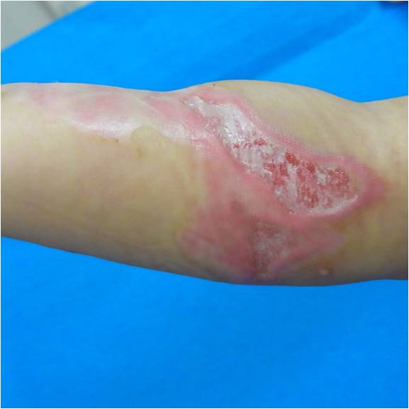 f:id:pediatrician:20120822110948j:image