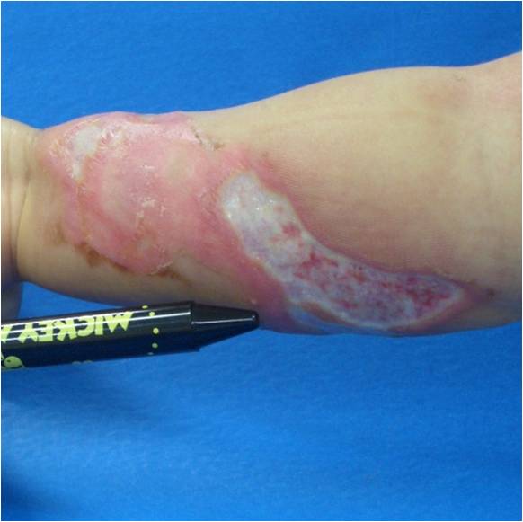 f:id:pediatrician:20120822110949j:image