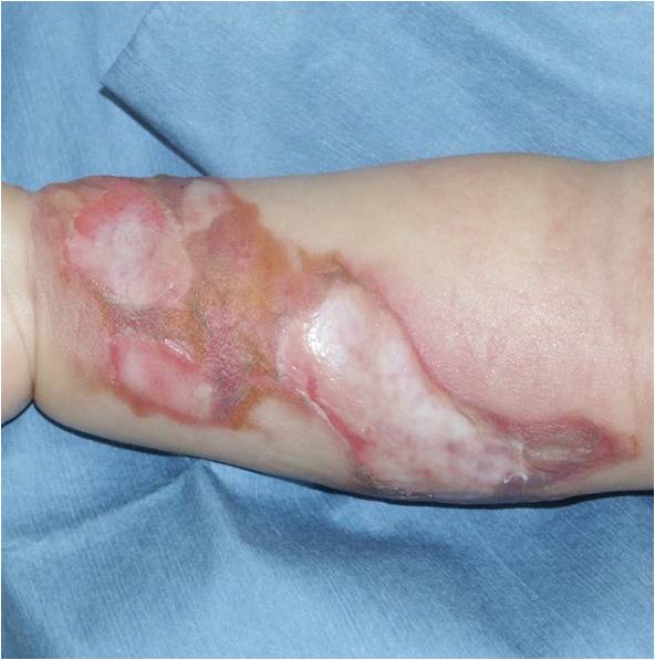 f:id:pediatrician:20120822110951j:image