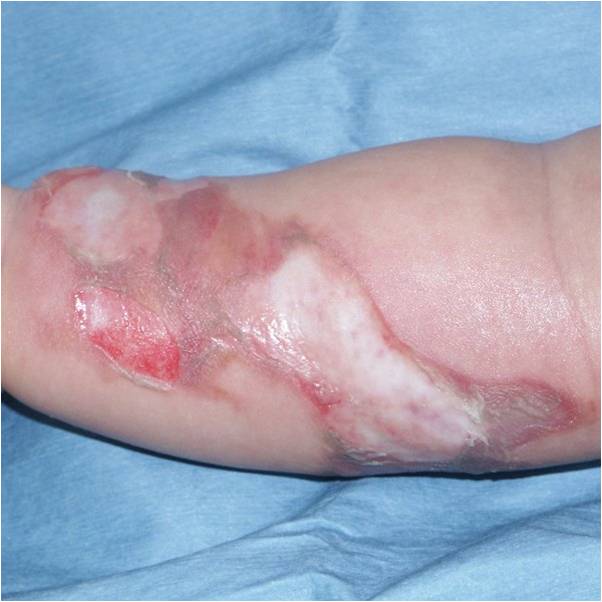 f:id:pediatrician:20120822110952j:image
