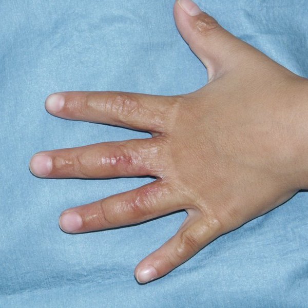 f:id:pediatrician:20121015120430j:image