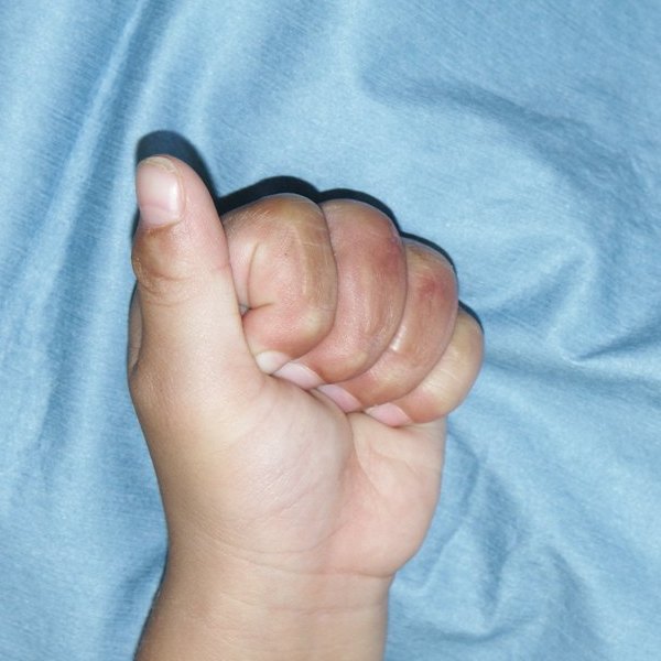 f:id:pediatrician:20121015120440j:image