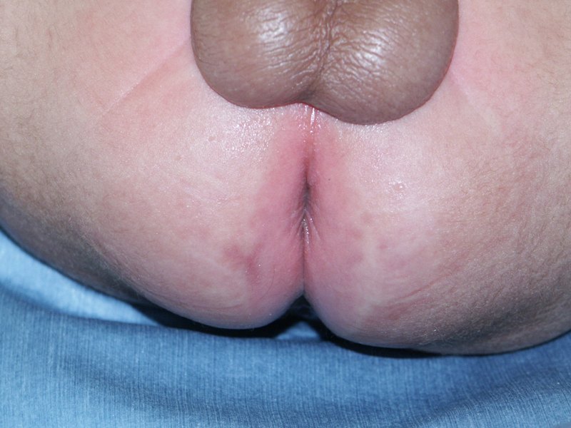 f:id:pediatrician:20121214175148j:image