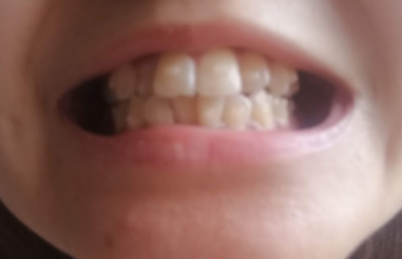 f:id:pekolog:20200201222509j:plain f:id:pekolog:20200201222509j:plain