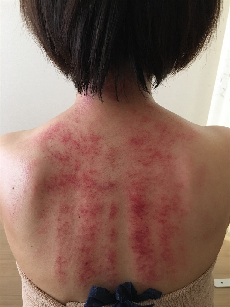 f:id:peonykanpo:20200630002906j:image f:id:peonykanpo:20200630002906j:image