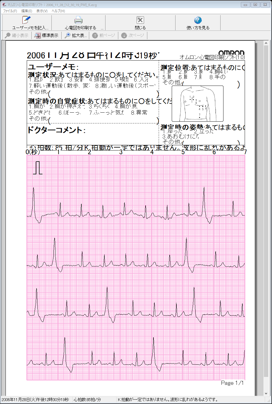 f:id:pepeprism:20200927015554j:plain f:id:pepeprism:20200927015554j:plain