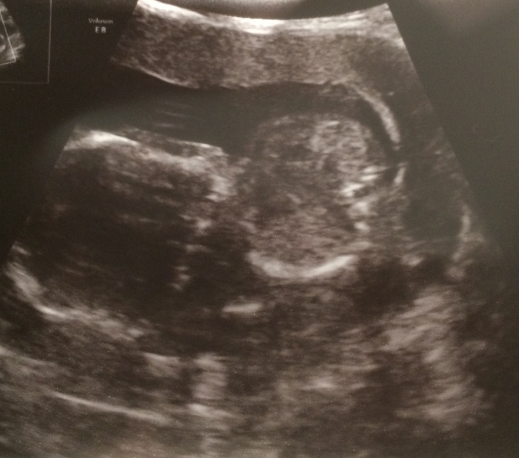 f:id:peugeot-106-s16:20171221223149j:plain f:id:peugeot-106-s16:20171221223149j:plain