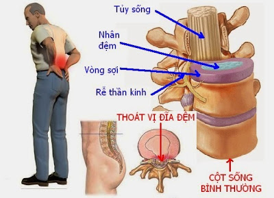 f:id:phamthuong6350:20171016131913j:plain f:id:phamthuong6350:20171016131913j:plain