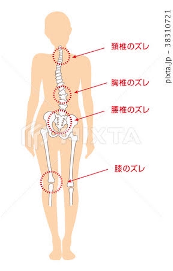 f:id:physicaladviser:20181207141918j:image
