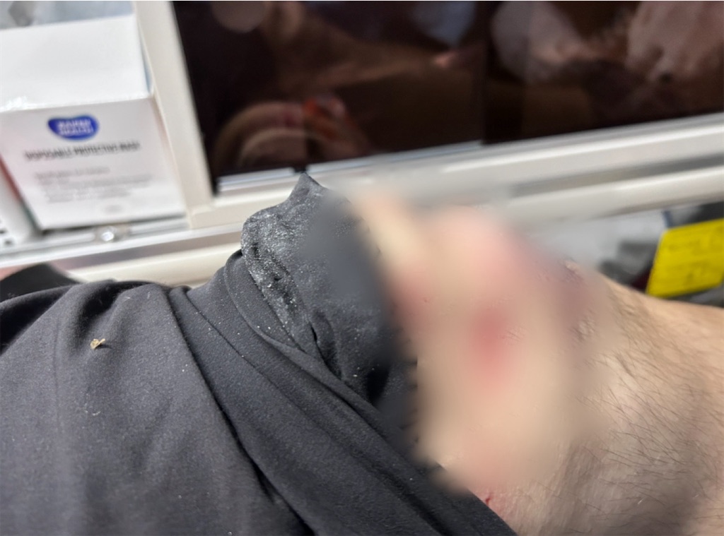 f:id:physicalist:20240618124256j:image f:id:physicalist:20240618124256j:image