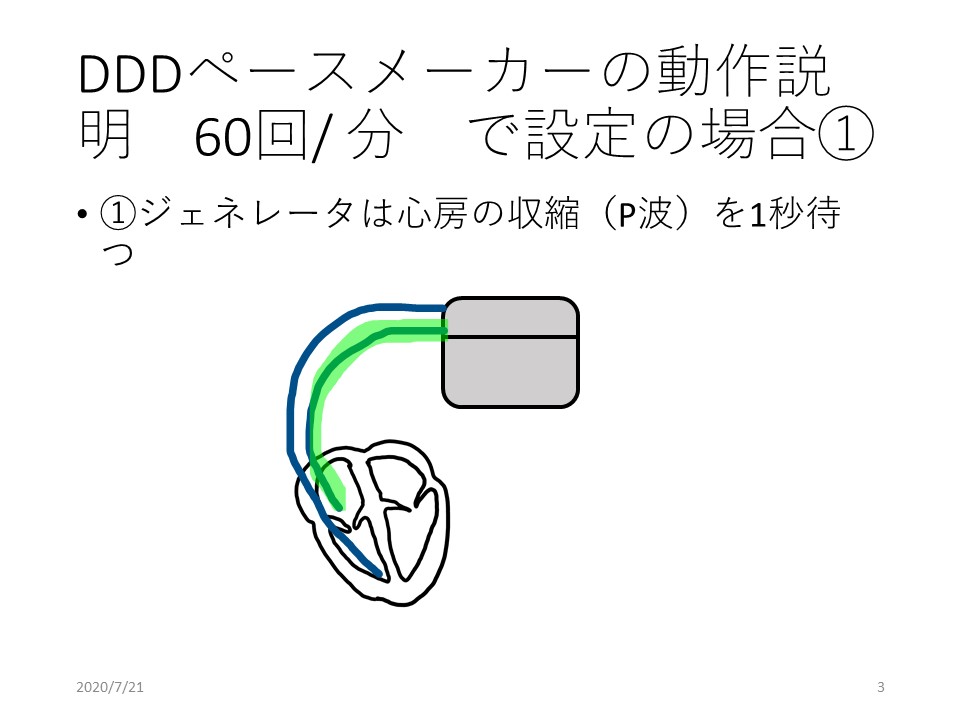 f:id:physicsforCE:20200721124637j:plain f:id:physicsforCE:20200721124637j:plain