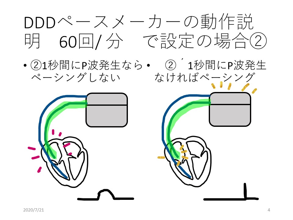 f:id:physicsforCE:20200721124640j:plain f:id:physicsforCE:20200721124640j:plain