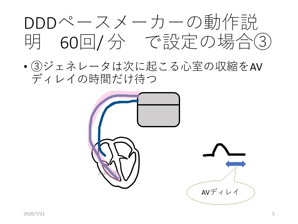f:id:physicsforCE:20200721124643j:plain f:id:physicsforCE:20200721124643j:plain